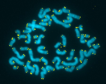 Telomeres highlighted in yellow on chromosomes