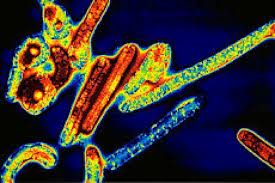 Ebola under the Microscope