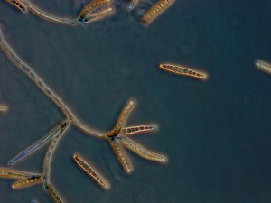 Exserohilum Rostratum fungus