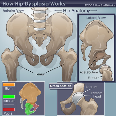 Scientists Say Fish Had Hip Bones