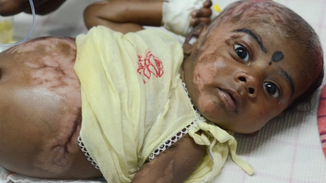 Baby Spontaneously Combusts