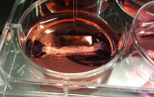 Lab Burger, Petri-Dish Patty, And Stem Cell Resurch