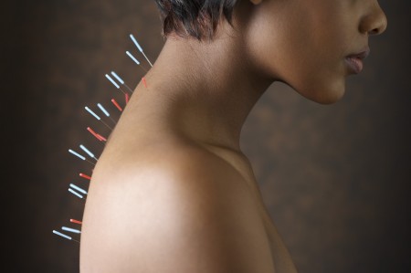 Acupuncture For Realignment