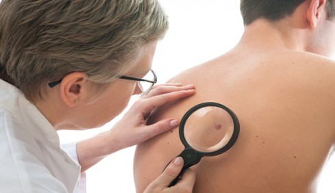 Scientist Claim New Drug Can Cure Skin Cancer