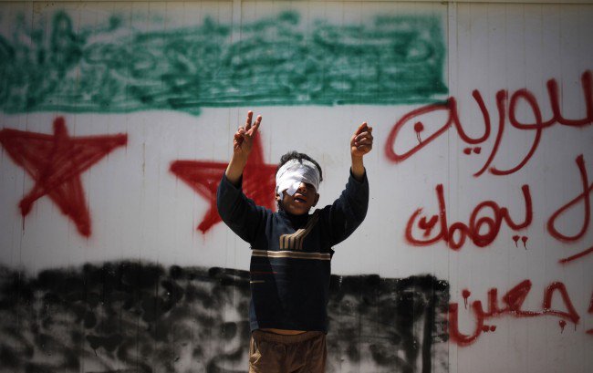 Wounded child in war torn Syria