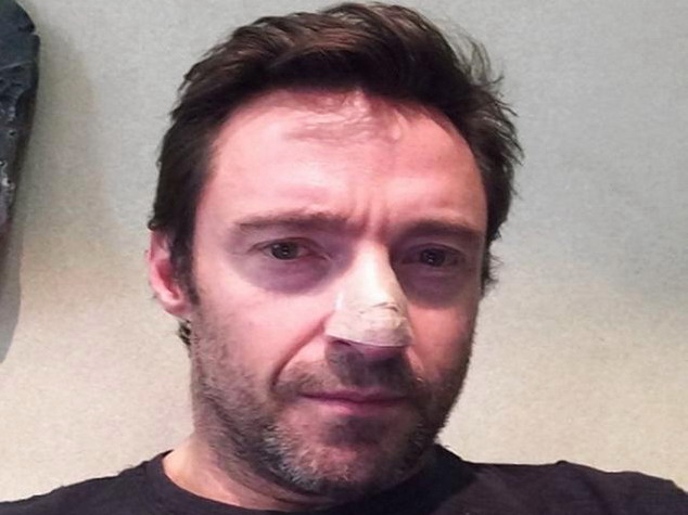 Hugh Jackman Treated for Skin Cancer