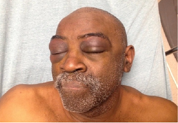 Officers beat deaf man because he could not hear their orders