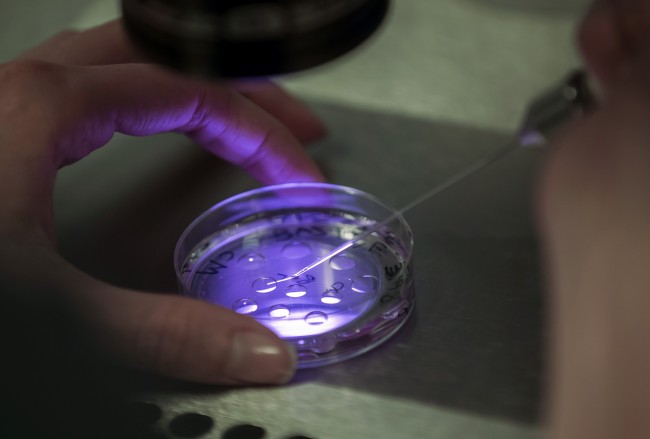 In Vitro Fertilization