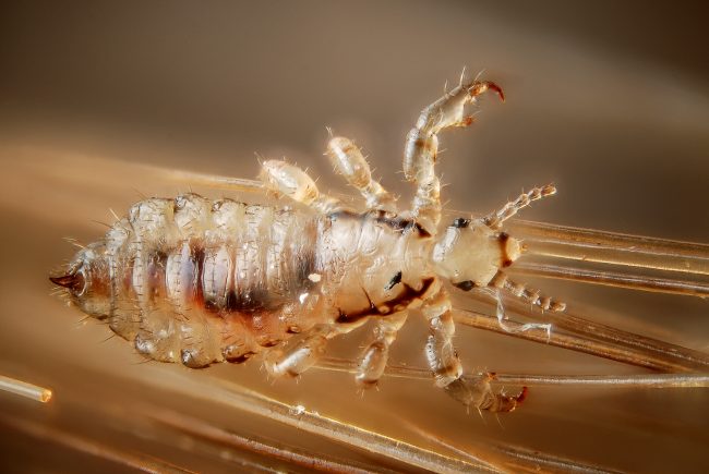 Head lice