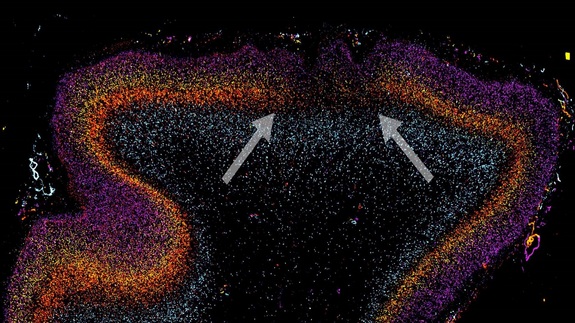autism research able to highlight irregularities in the cortex