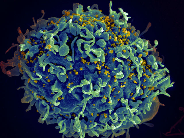 HIV Advancements, Genetic Alteration and Revived Newborns HIV