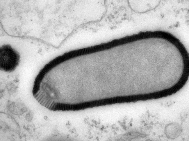 giant virus