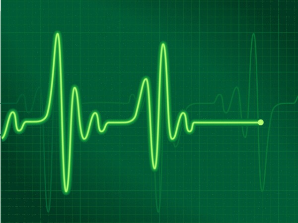Heartbeat Irregularity a Common Condition With Potential for Fatalities