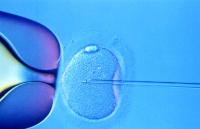 Fertility Mystery Solved With Discovery of Protein Key 1 fertility