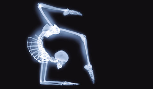 When Yoga Hurts: Misaligned Healing 