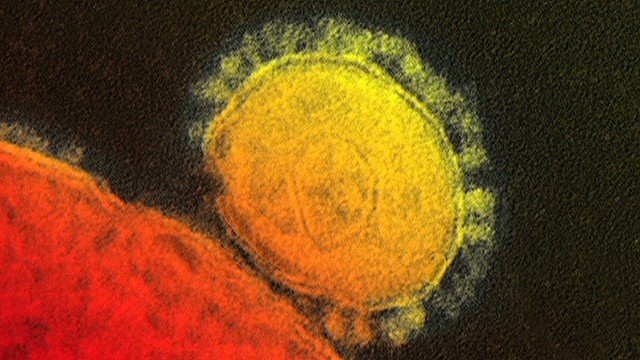 Indiana Health Care Professional Becomes First U.S. Case of MERS