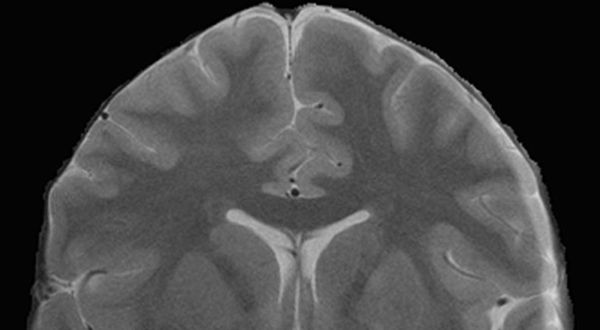 Science Never Supported Idea of Left Brain Vs. Right Brain, Now Say Idea is Hogwash