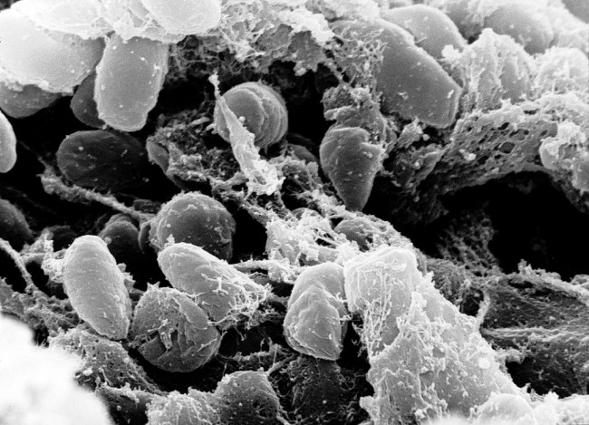 Colorado Citizen Identified As Having Pneumonic Plague
