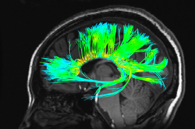 Psychedelic
