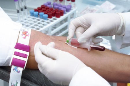 Scientists Acknowledge Blood Test Might Predict Alzheimer's Disease