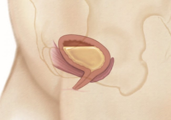 Urinary Incontinence Women s Health