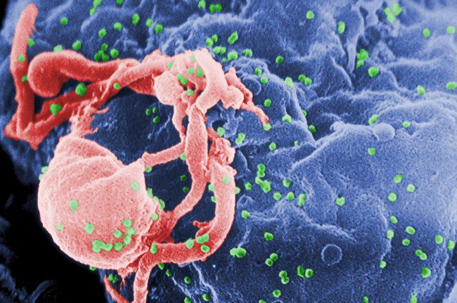 HIV Where Did It Come From? HIV