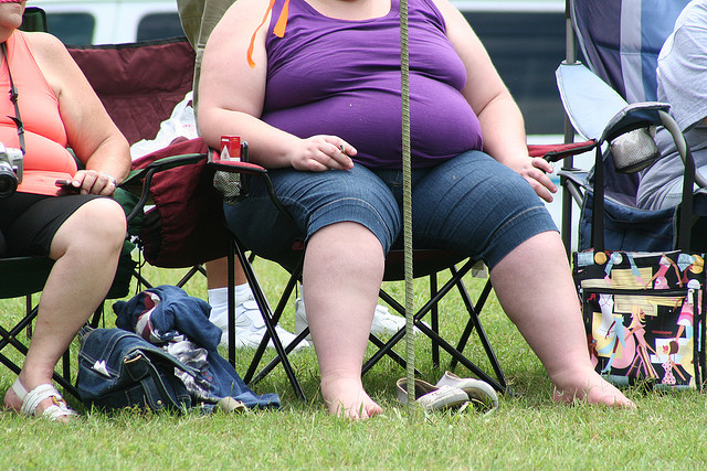Obesity Costs $2 Trillion