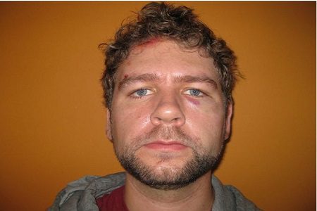 olice Brutality Continues As Pastor Suffers Horrible Beating