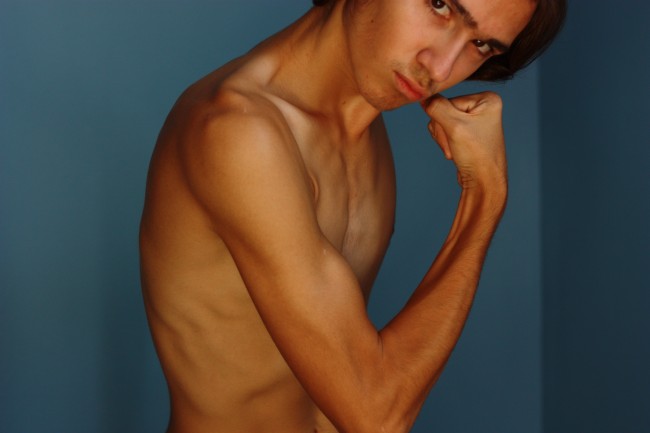 Male Eating Disorders Silent Epidemic Eating Disorders