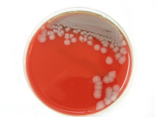 Anthrax Shipped Across United States by Mistake anthrax