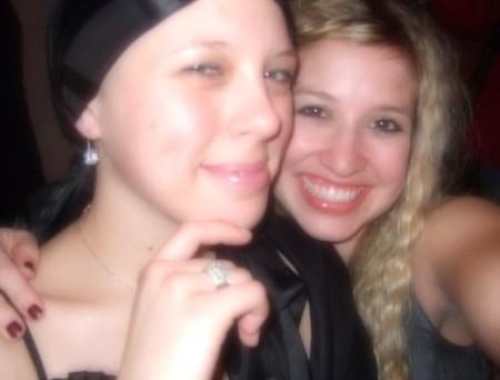 Prostate Cancer and Breast Cancer Are Parallel Diseases prostate cancer