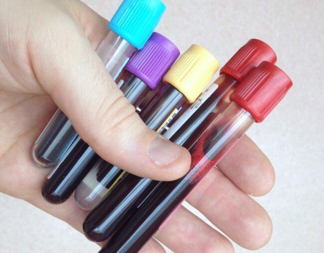 blood test