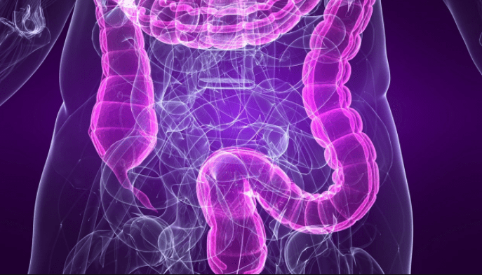 IBS