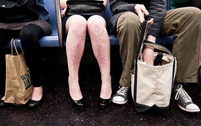 autoimmune disease