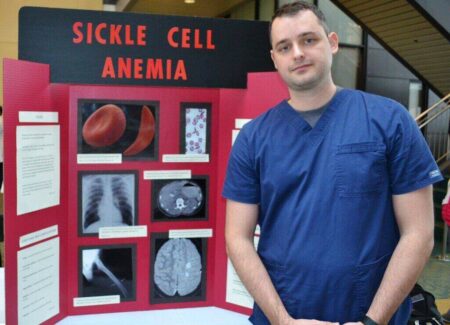 Gene-Editing Recipient of Sickle Cell Treatment Continues to Thrive sickle cell