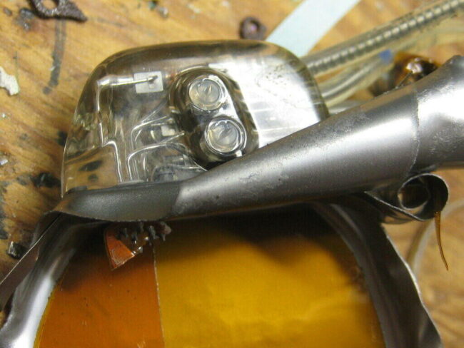 Implant Allows Paraplegics Walk Again implant