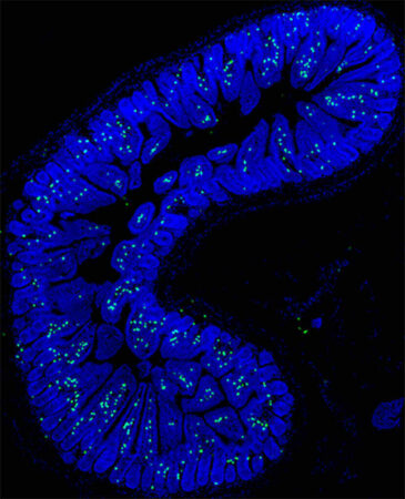 Immune Cell Diversity in the Human Body immune