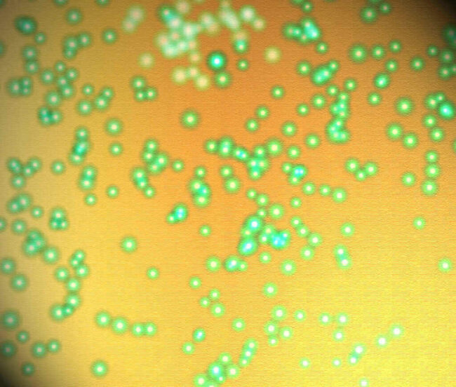 Measles Exposure Warning in Loudon County North Virginia Measles