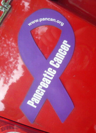 pancreatic cancer